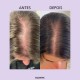 Suplemento Capilar para Cabelo e Menopausa – Crescimento, Brilho e Saúde | Glowwa Hair Food Meno™️